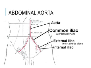 ABDOMINAL AORTA
Supracristal Plane
Interspinous plane
 