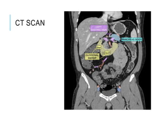 CT SCAN
 