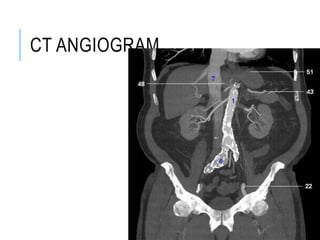 CT ANGIOGRAM
 