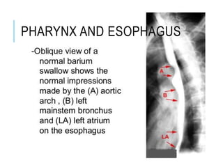 PHARYNX AND ESOPHAGUS
 