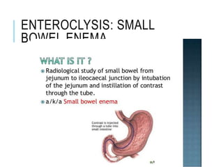 ENTEROCLYSIS: SMALL
BOWEL ENEMA
 