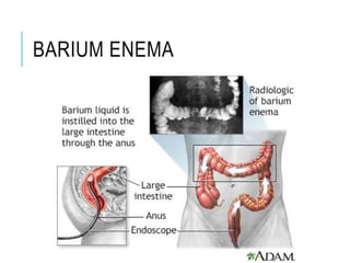 BARIUM ENEMA
 