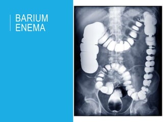 BARIUM
ENEMA
 