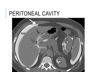 PERITONEAL CAVITY
 