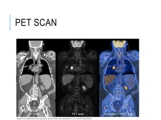 PET SCAN
 