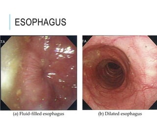 ESOPHAGUS
 