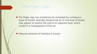 Abdominal x-ray interpretation ppt | PPTX