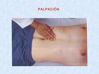 PALPACIÓN
 