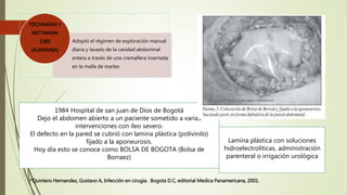 Adoptó el régimen de exploración manual
diaria y lavado de la cavidad abdominal
entera a través de una cremallera insertada
en la malla de marlex
TEICHMANN Y
WITTMANN
1980
(ALEMANIA)
1984 Hospital de san juan de Dios de Bogotá
Dejo el abdomen abierto a un paciente sometido a varias
intervenciones con íleo severo.
El defecto en la pared se cubrió con lamina plástica (polivinilo)
fijado a la aponeurosis.
Hoy día esto se conoce como BOLSA DE BOGOTA (Bolsa de
Borraez)
Lamina plástica con soluciones
hidroelectrolíticas, administración
parenteral o irrigación urológica
*Quintero Hernandez, Gustavo A, Infección en cirugia . Bogota D.C, editorial Medica Panamericana, 2001.
 