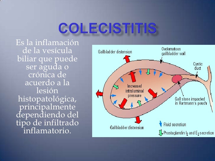 Los dolores constantes que tiran en los riñones el foro