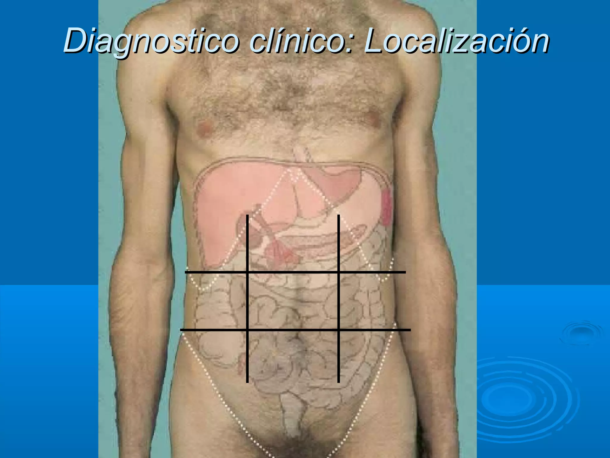 Diagnostico clínico: Localización
 