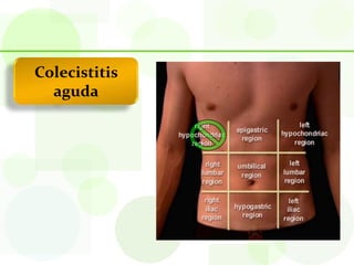 Colecistitis
  aguda
 