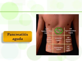 Pancreatitis
  aguda
 