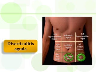 Diverticulitis
   aguda
 