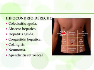 HIPOCONDRIO DERECHO
 Colecistitis aguda.
 Absceso hepático.
 Hepatitis aguda.
 Congestión hepática.
 Colangitis.
 Neumonía.
 Apendicitis retrocecal
 