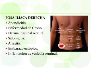 FOSA ILIACA DERECHA
 Apendicitis.
 Enfermedad de Crohn.
 Hernia inguinal o crural.
 Salpingitis.
 Anexitis.
 Embarazo ectópico.
 Inflamación de vesícula seminal.
 