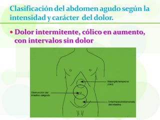 Clasificación del abdomen agudo según la
intensidad y carácter del dolor.
 Dolor intermitente, cólico en aumento,
 con intervalos sin dolor
 
