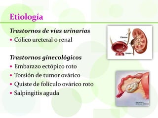 Etiología
Trastornos de vías urinarias
 Cólico ureteral o renal


Trastornos ginecológicos
 Embarazo ectópico roto
 Torsión de tumor ovárico
 Quiste de folículo ovárico roto
 Salpingitis aguda
 
