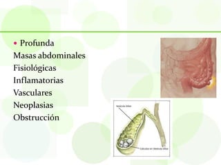  Profunda
Masas abdominales
Fisiológicas
Inflamatorias
Vasculares
Neoplasias
Obstrucción
 