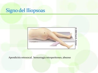 Signo del Iliopsoas




 Apendicitis retrocecal, hemorragia retroperitoneo, absceso
 