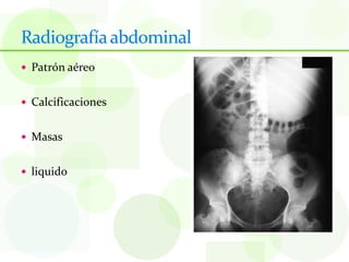 Radiografía abdominal
 Patrón aéreo


 Calcificaciones


 Masas


 liquido
 