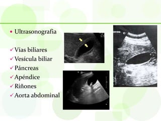  Ultrasonografia


 Vías biliares
 Vesícula biliar
 Páncreas
 Apéndice
 Riñones
 Aorta abdominal
 