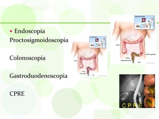  Endoscopia
Proctosigmoidoscopia

Colonoscopia

Gastroduodenoscopia

CPRE
 