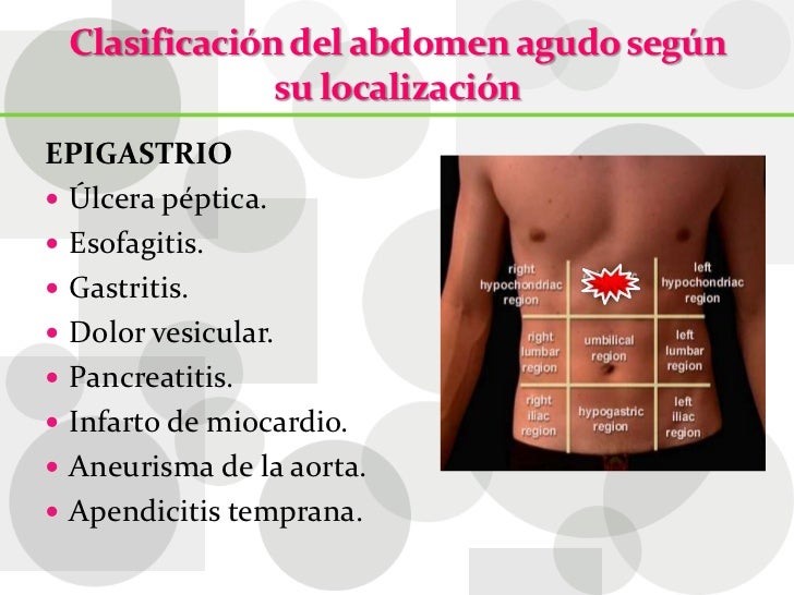Abdomen agudo