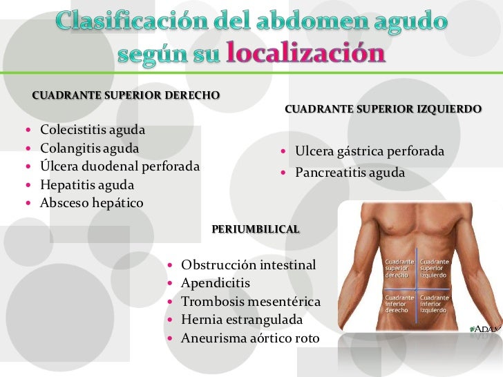 Abdomen agudo