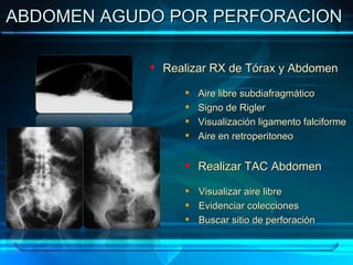 ABDOMEN AGUDO POR PERFORACION  Realizar RX de Tórax y Abdomen Aire libre subdiafragmático Signo de Rigler Visualización ligamento falciforme Aire en retroperitoneo Realizar TAC Abdomen Visualizar aire libre Evidenciar colecciones Buscar sitio de perforación 
