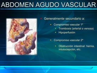 ABDOMEN AGUDO VASCULAR 