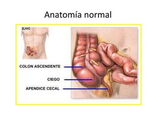 Anatomía normal
 