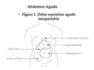 Abdomen Agudo
• Figura 1. Dolor repentino agudo
insoportable
•
 