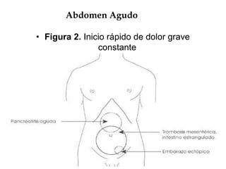Abdomen Agudo
• Figura 2. Inicio rápido de dolor grave
constante
•
 