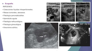 

Ecografía.

IMÁGENES:
• Colecciones líquidas intraperitoneales.
• Masas tumorales, abscesos.

• Patología pancreáticobiliar.
• Apendicitis aguda
• Patología nefrourológica.
• Patología ginecológica.

• Aneurisma aórtico.

 
