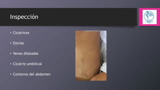 Inspección
• Cicatrices
• Estrías

• Venas dilatadas
• Cicatriz umbilical

• Contorno del abdomen

 