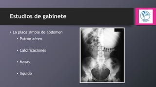 Estudios de gabinete
• La placa simple de abdomen
• Patrón aéreo
• Calcificaciones
• Masas
• liquido

 