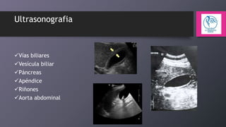 Ultrasonografia

Vías biliares
Vesícula biliar
Páncreas
Apéndice
Riñones
Aorta abdominal

 