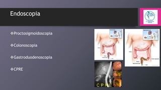 Endoscopia
Proctosigmoidoscopia
Colonoscopia
Gastroduodenoscopia
CPRE

 