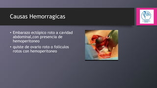 Causas Hemorragicas
• Embarazo ectópico roto a cavidad
abdominal,con presencia de
hemoperitoneo
• quiste de ovario roto o folículos
rotos con hemoperitoneo

 