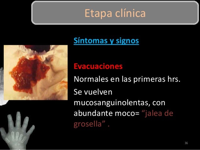 Abdomen agudo en pediatría