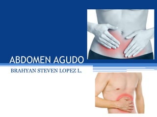 ABDOMEN AGUDO
BRAHYAN STEVEN LOPEZ L.
 