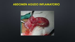 ABDOMEN AGUDO INFLAMATORIO
 