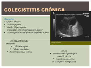 COLECISTITIS CRÓNICA
COMPLICACIONES
Predispone:
 Colecistitis aguda
 Cálculos en colédoco
 Adenocarcinoma de vesícula
D...