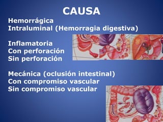 CAUSA
Hemorrágica
Intraluminal (Hemorragia digestiva)
Inflamatoria
Con perforación
Sin perforación
Mecánica (oclusión intestinal)
Con compromiso vascular
Sin compromiso vascular
 