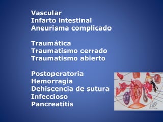 Vascular
Infarto intestinal
Aneurisma complicado
Traumática
Traumatismo cerrado
Traumatismo abierto
Postoperatoria
Hemorragia
Dehiscencia de sutura
Infeccioso
Pancreatitis
 