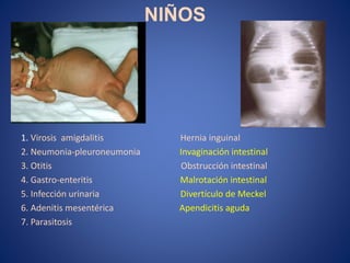 NIÑOS
1. Virosis amigdalitis Hernia inguinal
2. Neumonia-pleuroneumonia Invaginación intestinal
3. Otitis Obstrucción intestinal
4. Gastro-enteritis Malrotación intestinal
5. Infección urinaria Divertículo de Meckel
6. Adenitis mesentérica Apendicitis aguda
7. Parasitosis
 