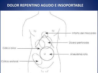 DOLOR REPENTINO AGUDO E INSOPORTABLE
 