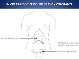 INICIO RAPIDO DEL DOLOR GRAVE Y CONSTANTE
 