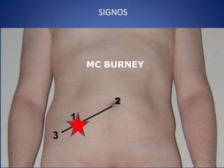 SIGNOS
MC BURNEY
 